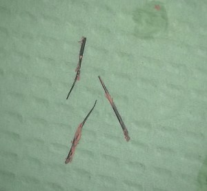 Photo in Endodontic Gallery