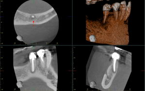 Galería de endodoncia