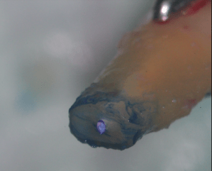 Galería de endodoncia