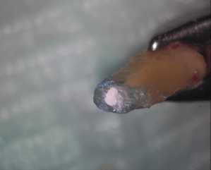 Galería de endodoncia